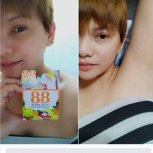 under arm cream - Picture 4 of 5